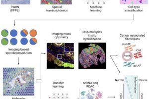 This graphic depicts a novel computational pipeline developed by Johns Hopkins Kimmel Cancer Researchers to identify early molecular and cellular progression to pancreatic ductal adenocarcinoma. Credit: Johns Hopkins Kimmel Cancer Center 